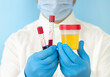 Doctor holding urine and blood samples for test