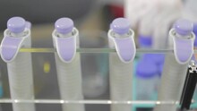 Medical Equipment Plastic Test Syringe