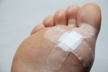 close up foot with plaster after surgery to remove verruca. injury feet. white patch protects the wo