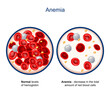 © designua - Anemia. Close-up of blood vessel with erythrocyte, platelets and white blood cells (lymphocytes)