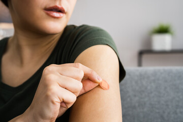 woman with contraception patch treatment