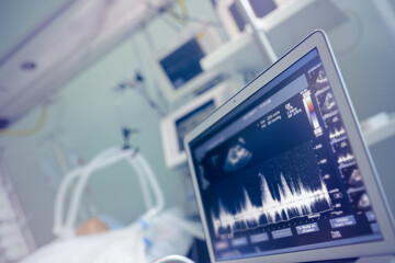 Wall Mural - Examination of the heart at the patient's bed. Ultrasound test of the heart on the screen of a modern device