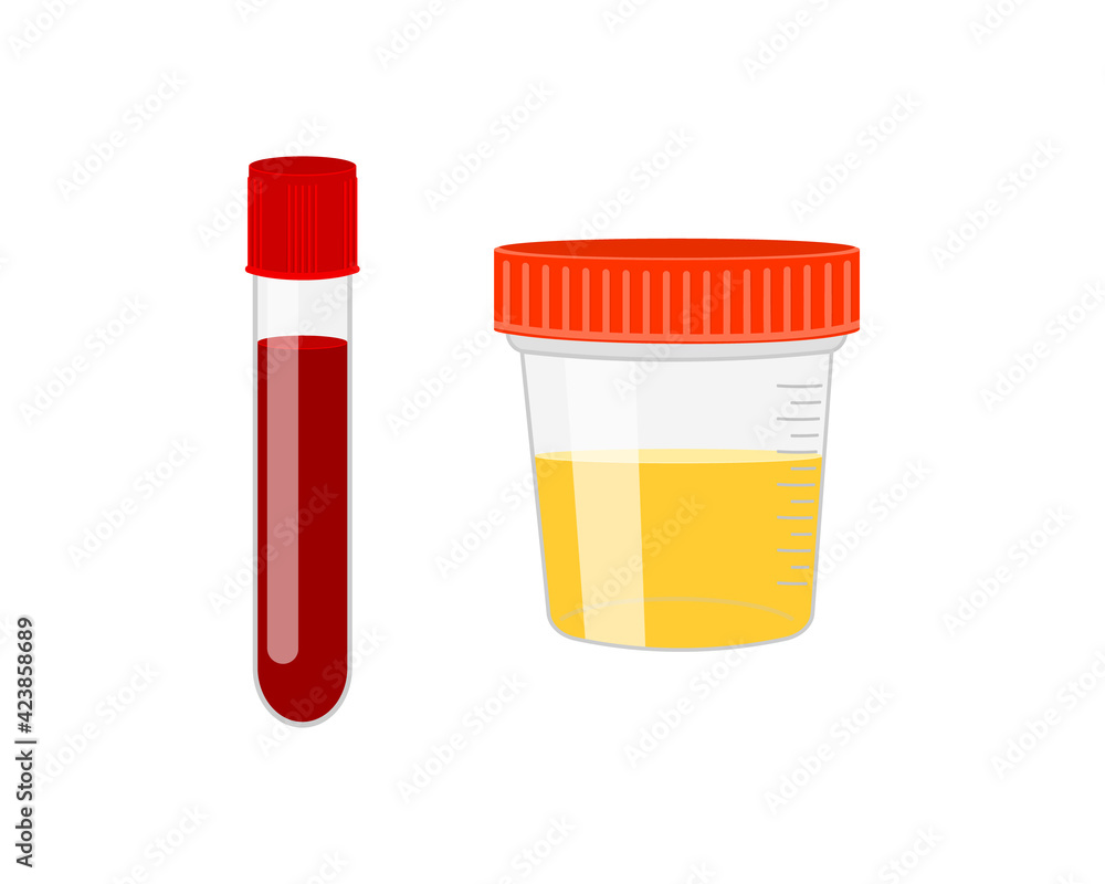 Test tube with blood and urine sample container isolated on white ...