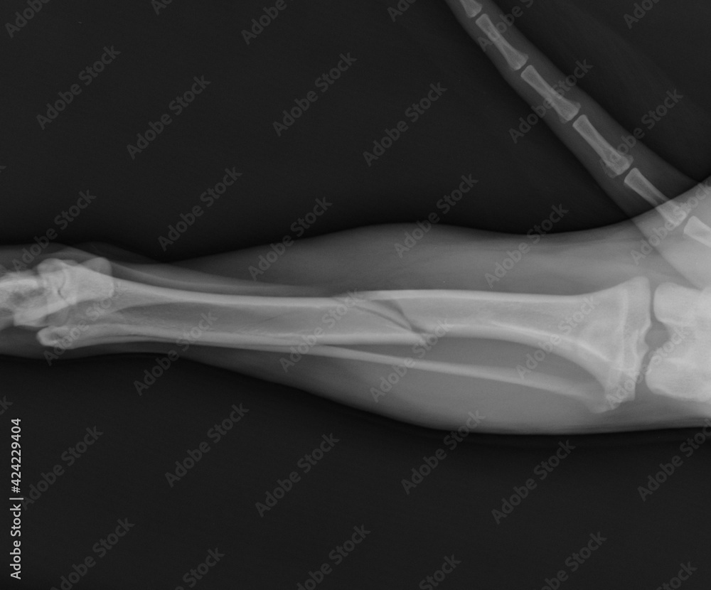 Dog tibial fracture x ray
