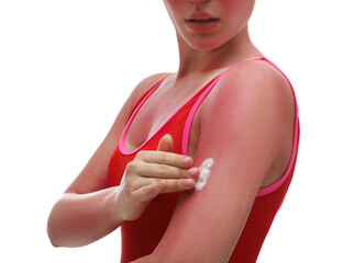 Wall Mural - Woman applying cream on sunburn against white background, closeup