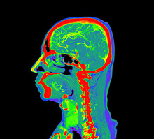 Colorful Of CT Angiography Of The Brain Or CTA Brain  Sagittal View . Clipping Path.