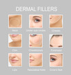 canvas print picture - dermal filler treatments .Hyaluronic acid injections for specific areas.Correct wrinkles	
