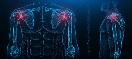 Polygonal vector illustration of a painful shoulder joint. Shoulder joint disease. Diseases of the human musculoskeletal system