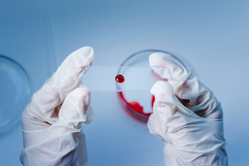 Medical laboratory. A glass plate with blood in the hand in a medical glove on a blue background. The concept of laboratory research.