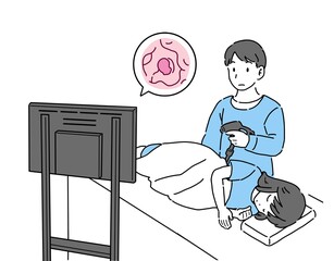 大腸内視鏡検査を行う女性と医者のイラスト