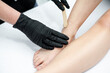 © alipko - Sugaring epilations legs procedure for woman