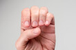 © Magryt - Healthy short nails after treatment. Clean short cutted nails after manicure. Beauty and skincare concept.