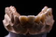 Mold of teeth. Gypsum model plaster of teeth. Plaster cast of teeth from human in preparation for producing a dental crown. Dentistry and orthodontics concept
