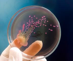 Poster - Bacteria colony on culture media plate, stool culture