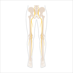 Sticker - Sciatica pain concept