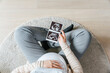 Top view of unrecognizable pregnant woman while touching her belly and watching ultrasound in anticipation of birth of baby girl sitting on wooden house floor - Concept of motherhood and happiness