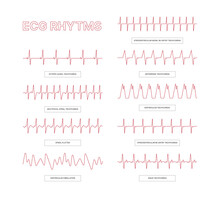 Ecg Templates. Medical Infographic Lines Heart Arrhythmia Health Conceptual Pictures For Doctors Info Garish Vector Ecg Illustrations
