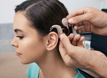 Cochlear Implant. Installation Cochlear Implant On Woman's Ear For Restores Hearing