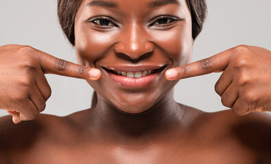 Wall Mural - Lip Care Concept. Beautiful Smiling Black Woman Pointing At Her Plump Lips