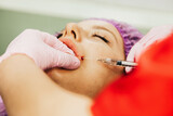Fototapeta  - Woman gets an injection with hyaluronic acid as a dermal filler for lip enlargement
