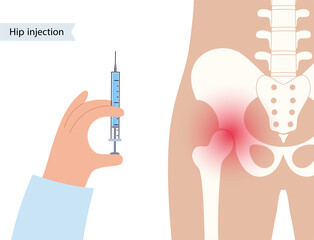 Sticker - Hip joint injection