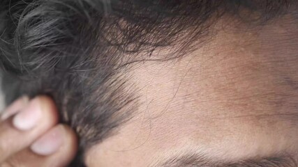 hair loss concept with man checking his hair 