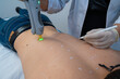 © Enrique Espinosa/ADDICTIVE STOCK - Unrecognizable master using modern laser on back of male client for hair removal in beauty clinic