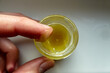Gelbe Salbe in einem runden Glas wird von einem Finger prüfend entnommen. Zähflüssige gelbe leicht transparente Masse. Hamamelis-Salbe gegen Hämorrhoiden. Disgusting ointment with earwax.