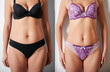 © anatoliy_gleb - Front view of woman's body before and after weight loss, plastic surgery concept