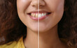 © Pixel-Shot - Beautiful young woman before and after smile makeover procedure, closeup