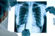 close up. doctors in protective clothing discussing an x-ray of the lungs .