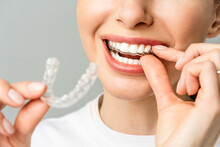 A Young Woman Does A Home Teeth Whitening Procedure. Whitening Tray With Gel