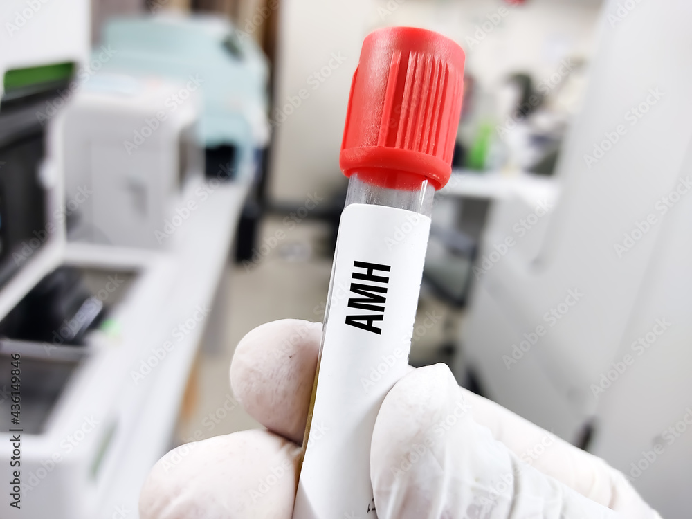 Blood sample tube for anti-Müllerian hormone or AMH test, evaluate of ...