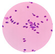 Leucocytozoon spp. in a stained blood smear from a chicken. Leukocytozoon in avian blood. Parasites of the genus Leukocytozoon infect both domestic fowl (ducks, geese) and wild birds of many species.