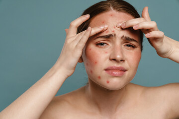 Wall Mural - Ginger shirtless woman frowning and squeezing pimple on her face