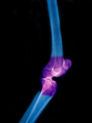 x ray of human knee