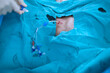 anesthetist setting central venous catheter to patient before open heart surgery