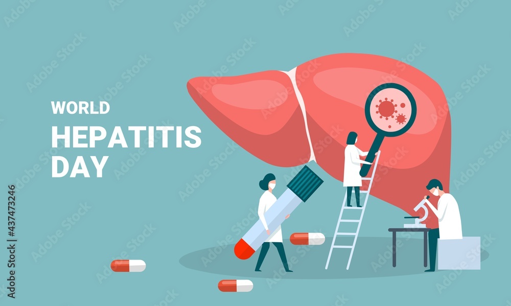 Concept of hepatitis A, B, C, D, cirrhosis, world hepatitis day. Tiny doctors treat the liver. vector illustration. - obrazy, fototapety, plakaty 