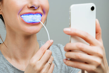 A young woman is engaged in home teeth whitening. Complex for teeth whitening with UV lamp