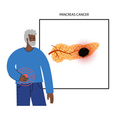 Canvas Print - Pancreas disease and cancer