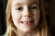 © Jennifer Bogle/Stocksy - Closeup of smiling  girl with missing tooth