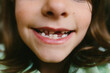 © Maria Manco/Stocksy - closeup of little kid with missing tooth