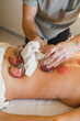 © Irina Efremova/Stocksy - Removing hijama cups