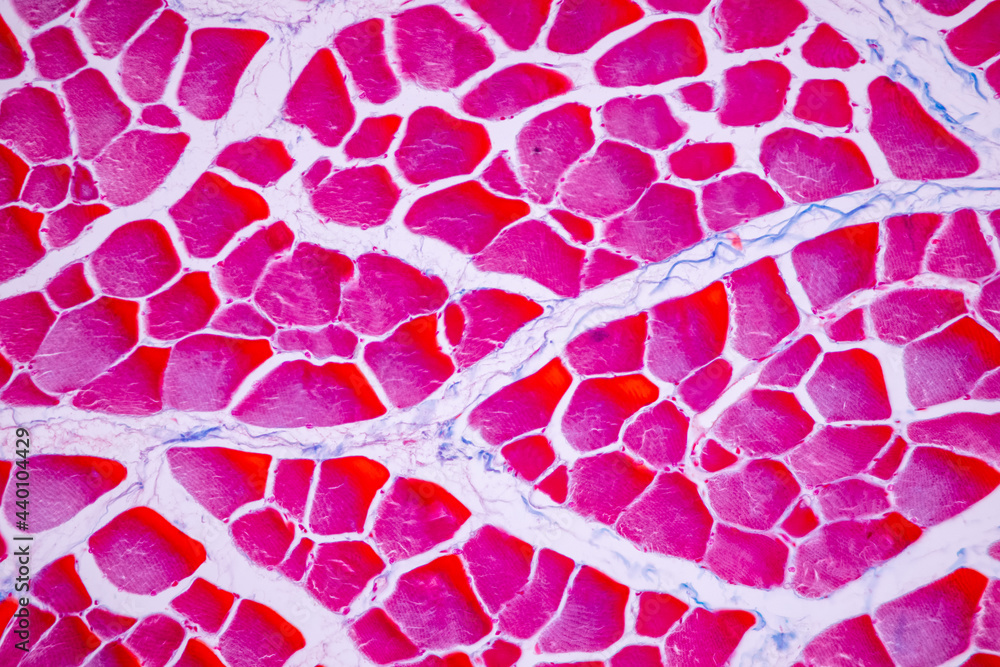 Foto Characteristics of anatomy and Histological sample Striated ...
