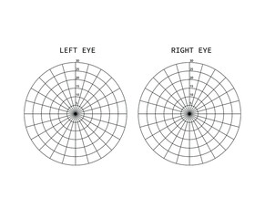 Wall Mural - Amsler test grid. Eye scotoma chart. Oculist Vector printable chart retina examination. Grid with dot in centre. Vision control.