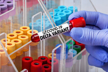 Doctor Epidemiologist Holding Blood Tube For Test Detection Of Virus Covid-19 Delta Variant With Positive Result. Doctor Testing Blood Test Tube From Patient Infected With Coronavirus Delta Variant