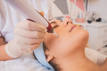 Canvas Print - Closeup shot of a beautiful Hispanic woman getting fractional mesotherapy in the spa