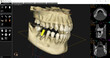 Dental CBCT image