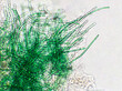 Leinwandbild Motiv Nostoc sp. algae under microscopic view, Cyanobacteria, Blue green algae