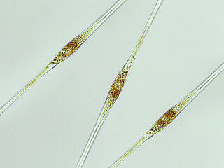 cylindrotheca sp. algae under microscopic view, diatoms